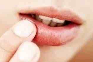 嘴唇发麻可能有这些疾病